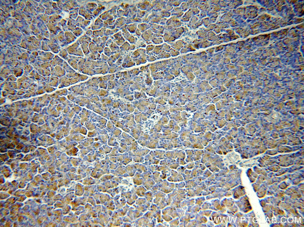 Immunohistochemistry (IHC) staining of human pancreas tissue using CEPT1 Polyclonal antibody (20496-1-AP)