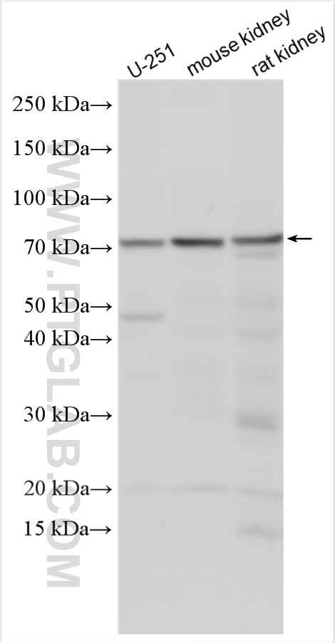 Western Blot (WB) analysis of various lysates using CER1 Polyclonal antibody (18879-1-AP)