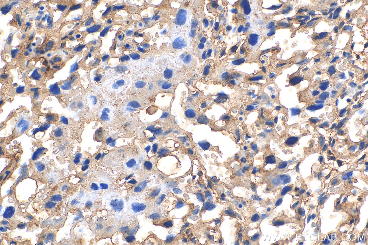 Immunohistochemistry (IHC) staining of mouse placenta tissue using CERCAM Polyclonal antibody (16411-1-AP)