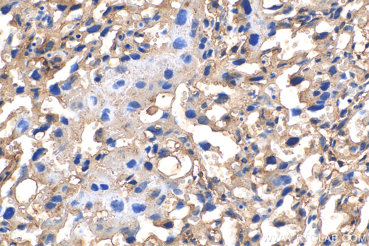 IHC staining of mouse placenta using 16411-1-AP