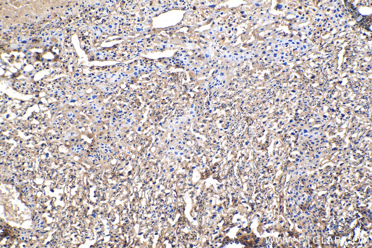 Immunohistochemistry (IHC) staining of mouse placenta tissue using CERCAM Polyclonal antibody (16411-1-AP)