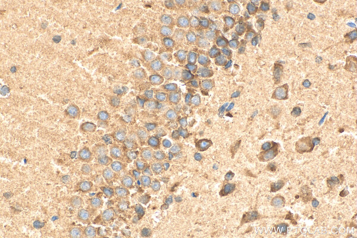 Immunohistochemistry (IHC) staining of rat brain tissue using CERCAM Polyclonal antibody (16411-1-AP)