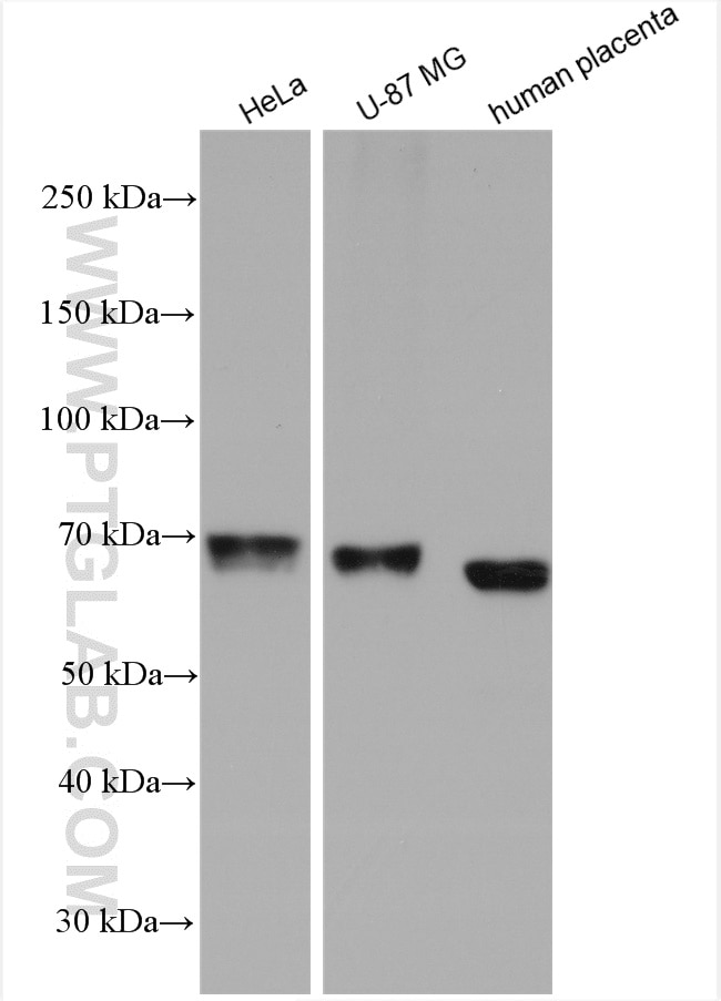 Western Blot (WB) analysis of various lysates using CERCAM Polyclonal antibody (16411-1-AP)