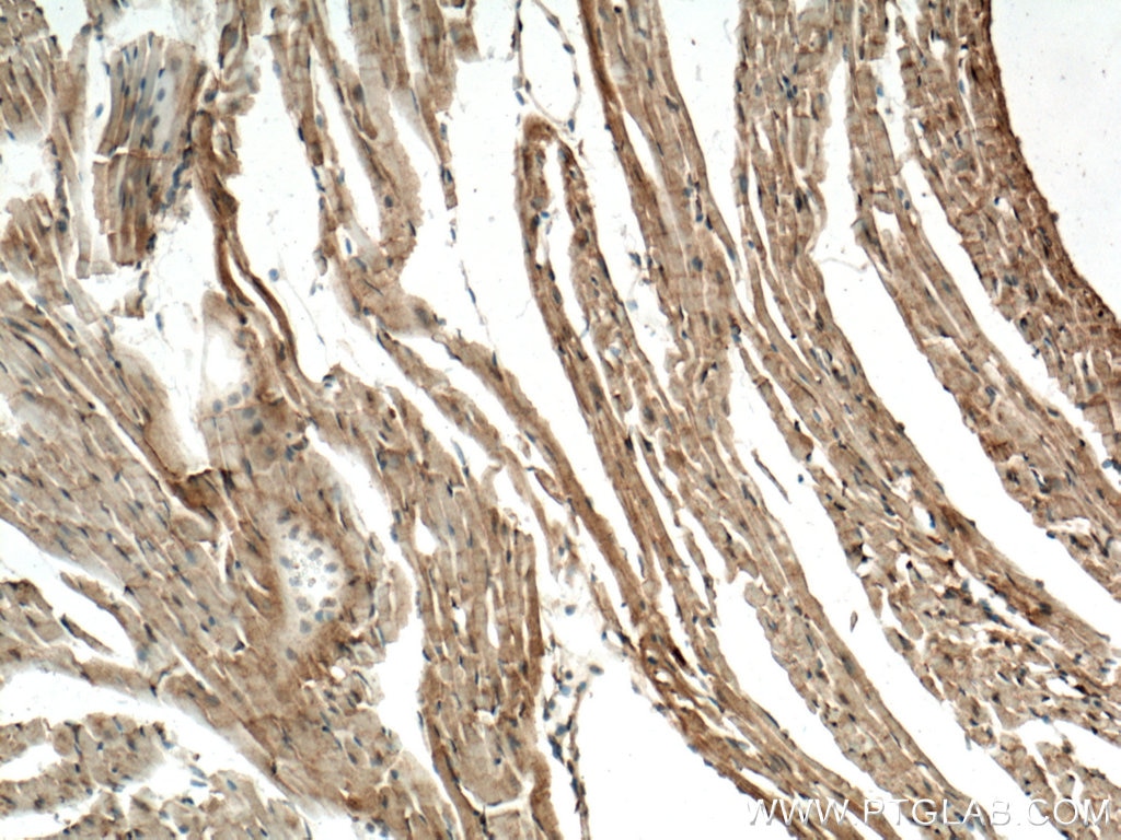 Immunohistochemistry (IHC) staining of mouse heart tissue using CERK Polyclonal antibody (25731-1-AP)