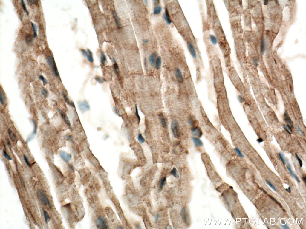 Immunohistochemistry (IHC) staining of mouse heart tissue using CERK Polyclonal antibody (25731-1-AP)