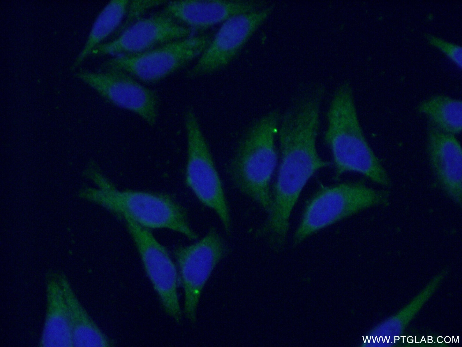 Immunofluorescence (IF) / fluorescent staining of HepG2 cells using CES1 Polyclonal antibody (16912-1-AP)