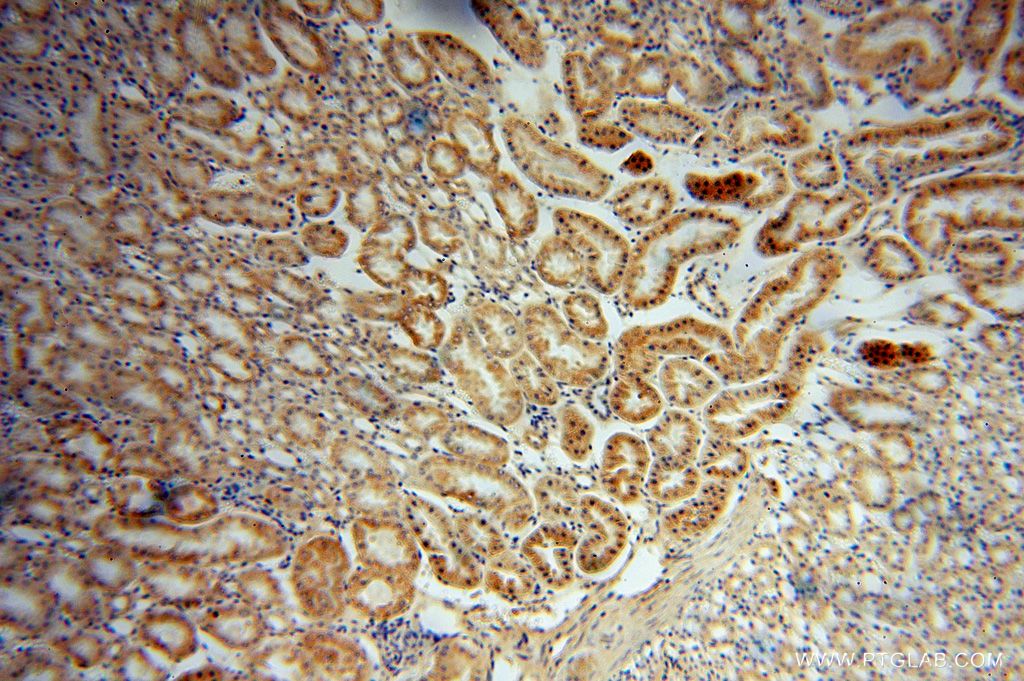Immunohistochemistry (IHC) staining of human kidney tissue using CES1 Polyclonal antibody (16912-1-AP)