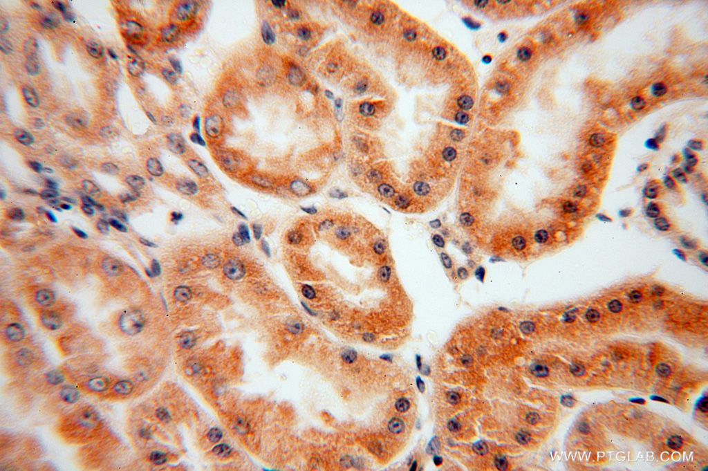 IHC staining of human kidney using 16912-1-AP