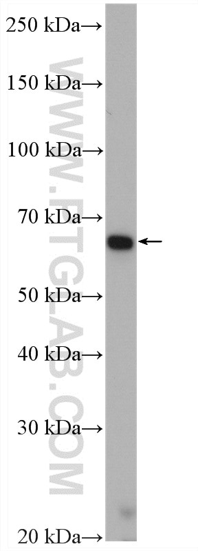 Western Blot (WB) analysis of Jurkat cells using CES1 Polyclonal antibody (16912-1-AP)