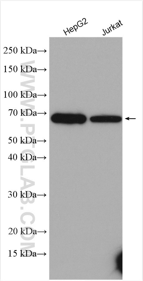 Western Blot (WB) analysis of various lysates using CES1 Polyclonal antibody (16912-1-AP)