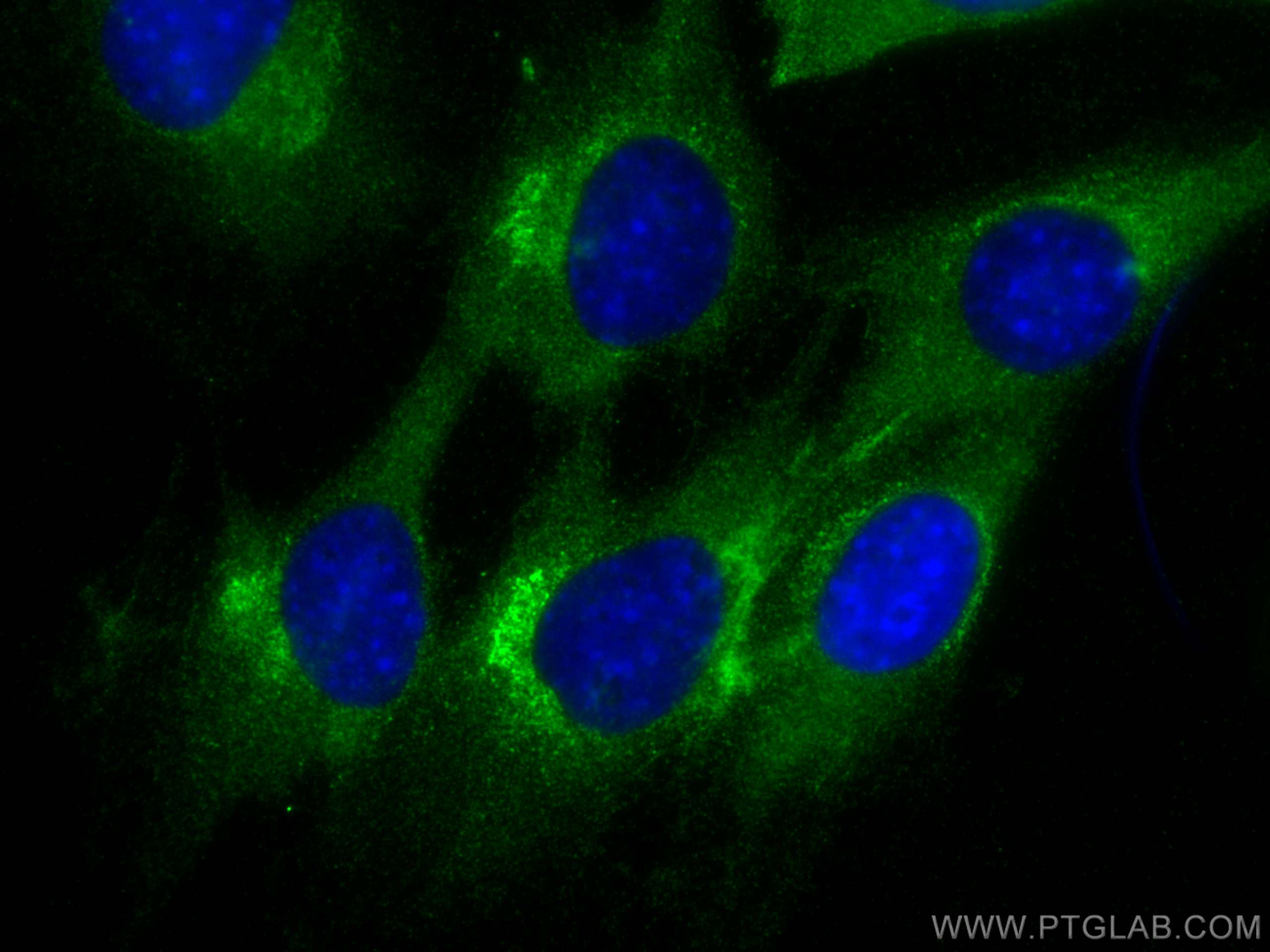 Immunofluorescence (IF) / fluorescent staining of C2C12 cells using CES1 Polyclonal antibody (29041-1-AP)