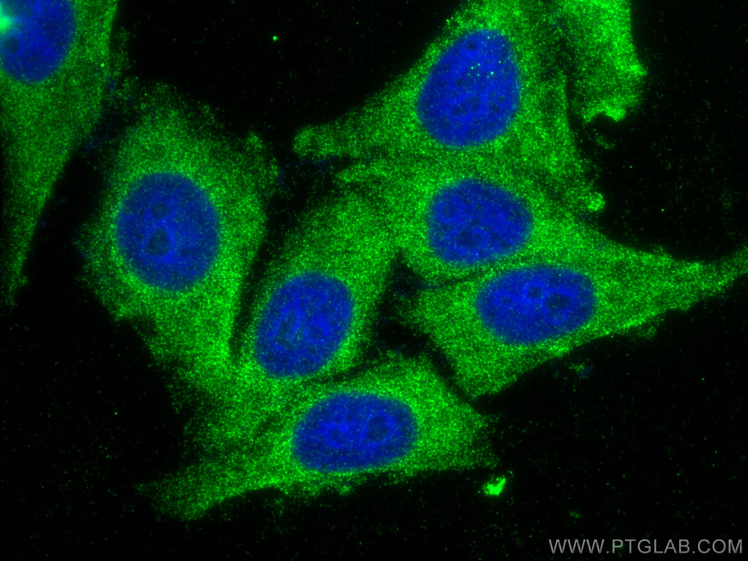 Immunofluorescence (IF) / fluorescent staining of HepG2 cells using CES1 Polyclonal antibody (29041-1-AP)
