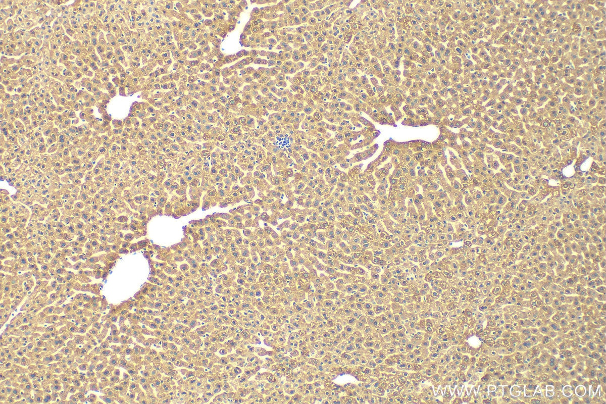 Immunohistochemistry (IHC) staining of mouse liver tissue using CES1 Polyclonal antibody (29041-1-AP)