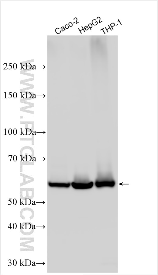 Western Blot (WB) analysis of various lysates using CES1 Polyclonal antibody (29041-1-AP)