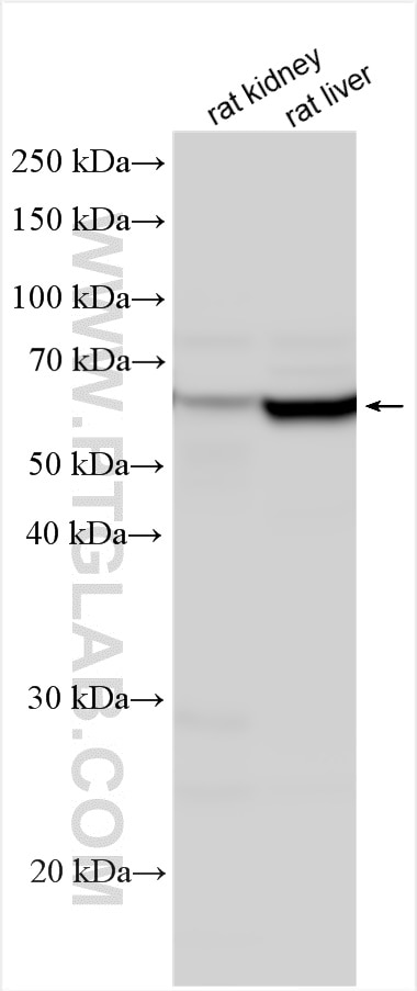 Western Blot (WB) analysis of various lysates using CES1 Polyclonal antibody (29041-1-AP)