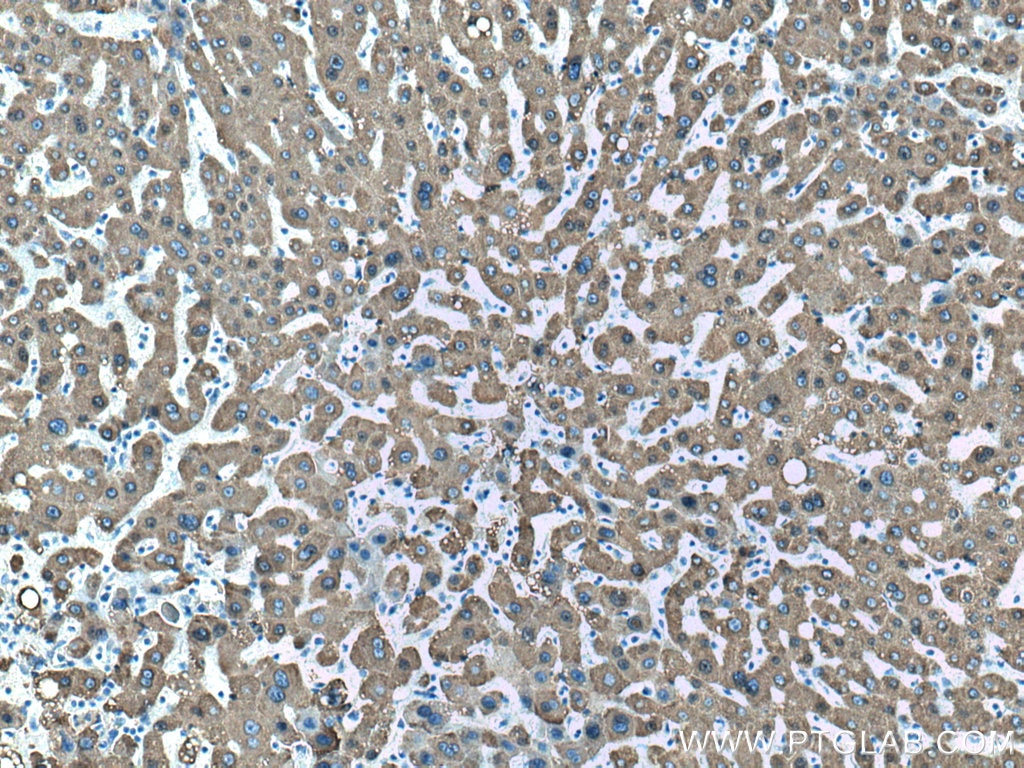 Immunohistochemistry (IHC) staining of human liver tissue using CES1 Monoclonal antibody (67079-1-Ig)