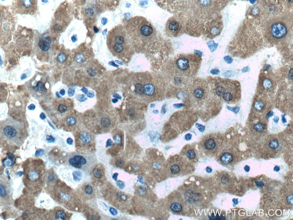 Immunohistochemistry (IHC) staining of human liver tissue using CES1 Monoclonal antibody (67079-1-Ig)