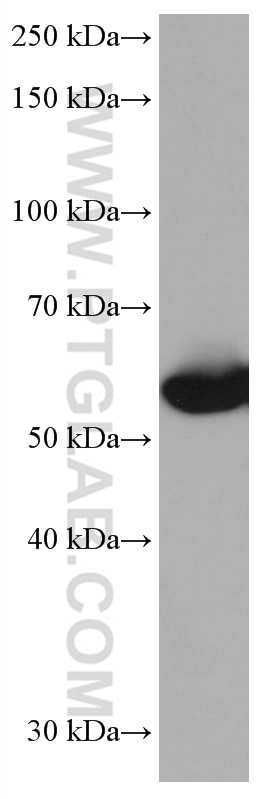 Western Blot (WB) analysis of THP-1 cells using CES1 Monoclonal antibody (67079-1-Ig)