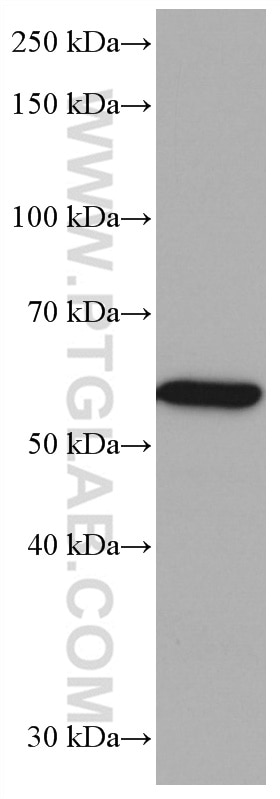 Western Blot (WB) analysis of U-937 cells using CES1 Monoclonal antibody (67079-1-Ig)