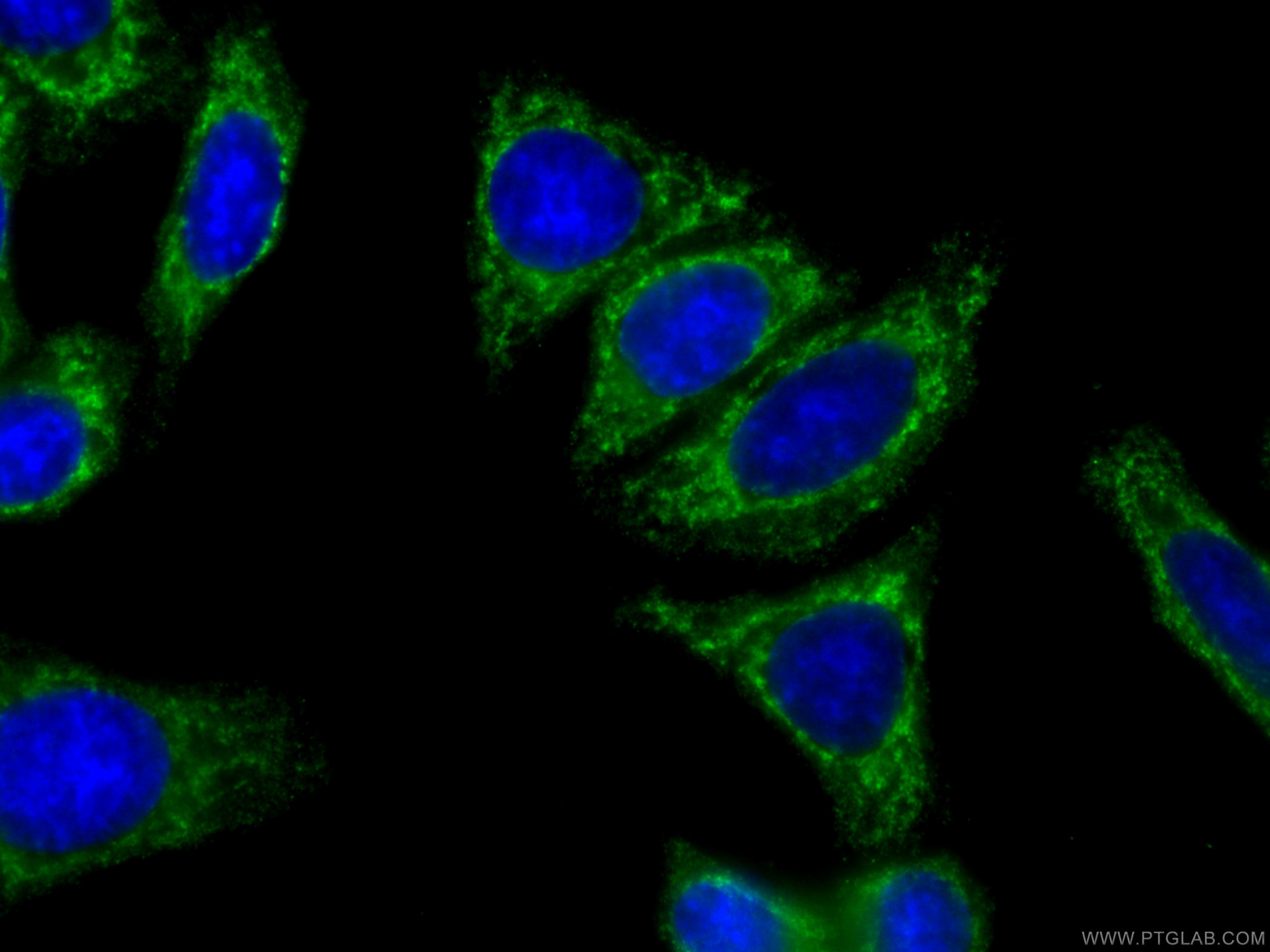 Immunofluorescence (IF) / fluorescent staining of HepG2 cells using CoraLite® Plus 488-conjugated CES1 Monoclonal anti (CL488-67079)