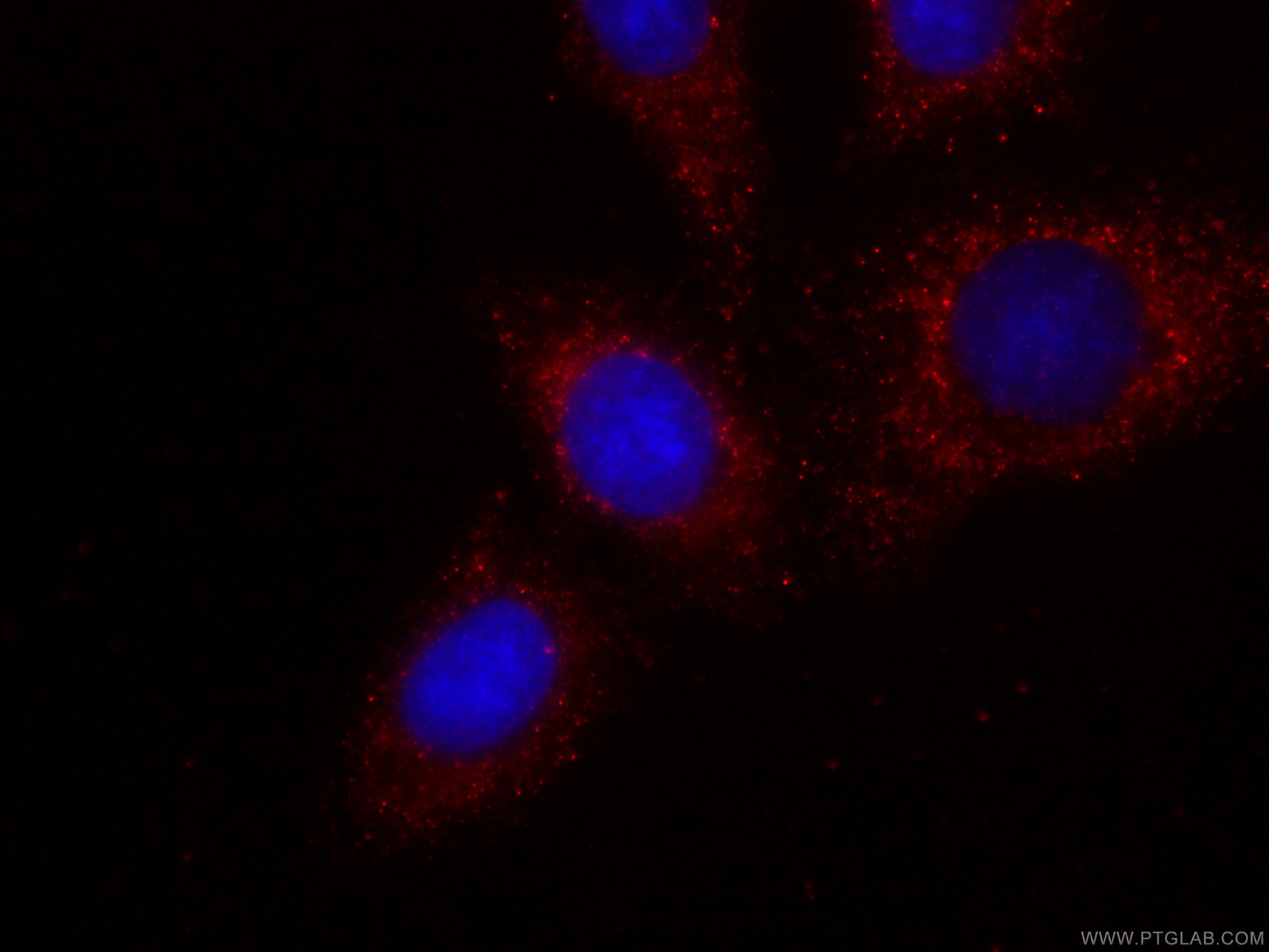 Immunofluorescence (IF) / fluorescent staining of HepG2 cells using CoraLite®594-conjugated CES1 Monoclonal antibody (CL594-67079)