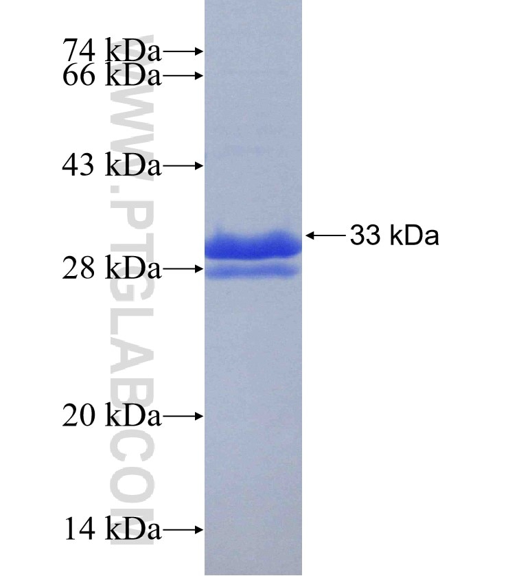 CES1 fusion protein Ag30534 SDS-PAGE
