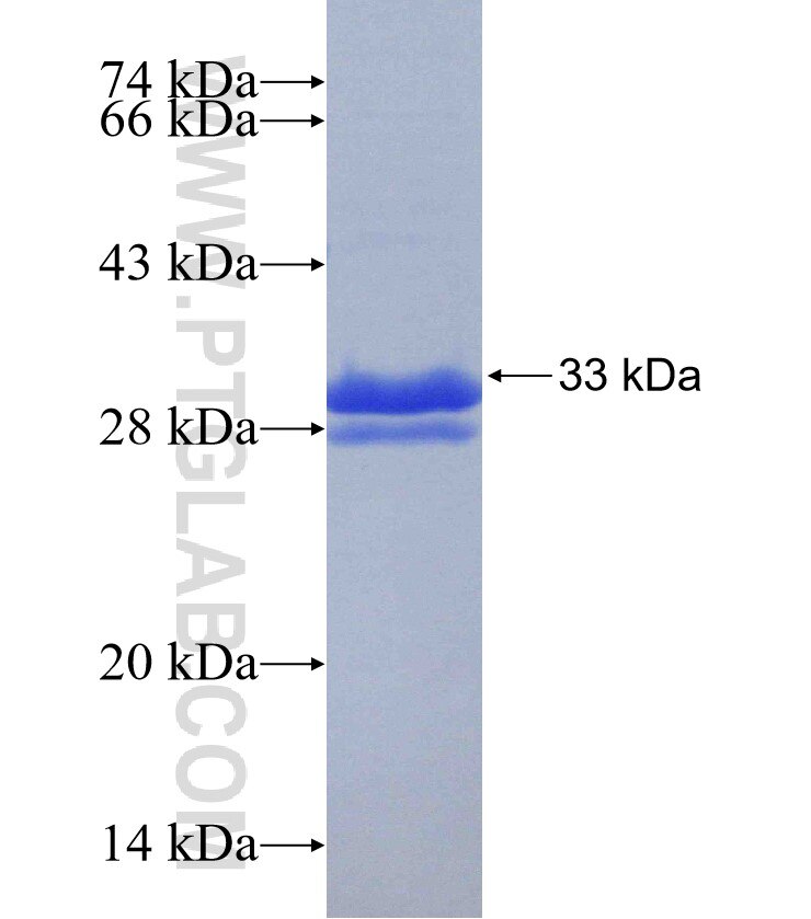 CES1 fusion protein Ag30534 SDS-PAGE