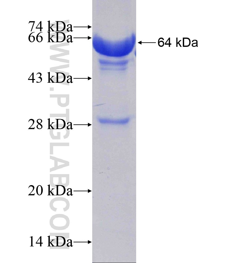 CES1 fusion protein Ag10567 SDS-PAGE