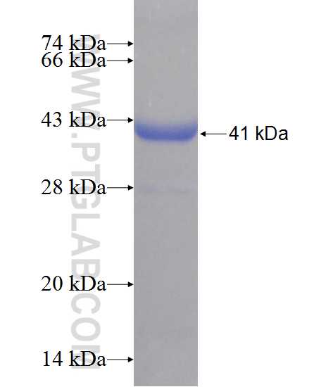 CES1 fusion protein Ag10647 SDS-PAGE