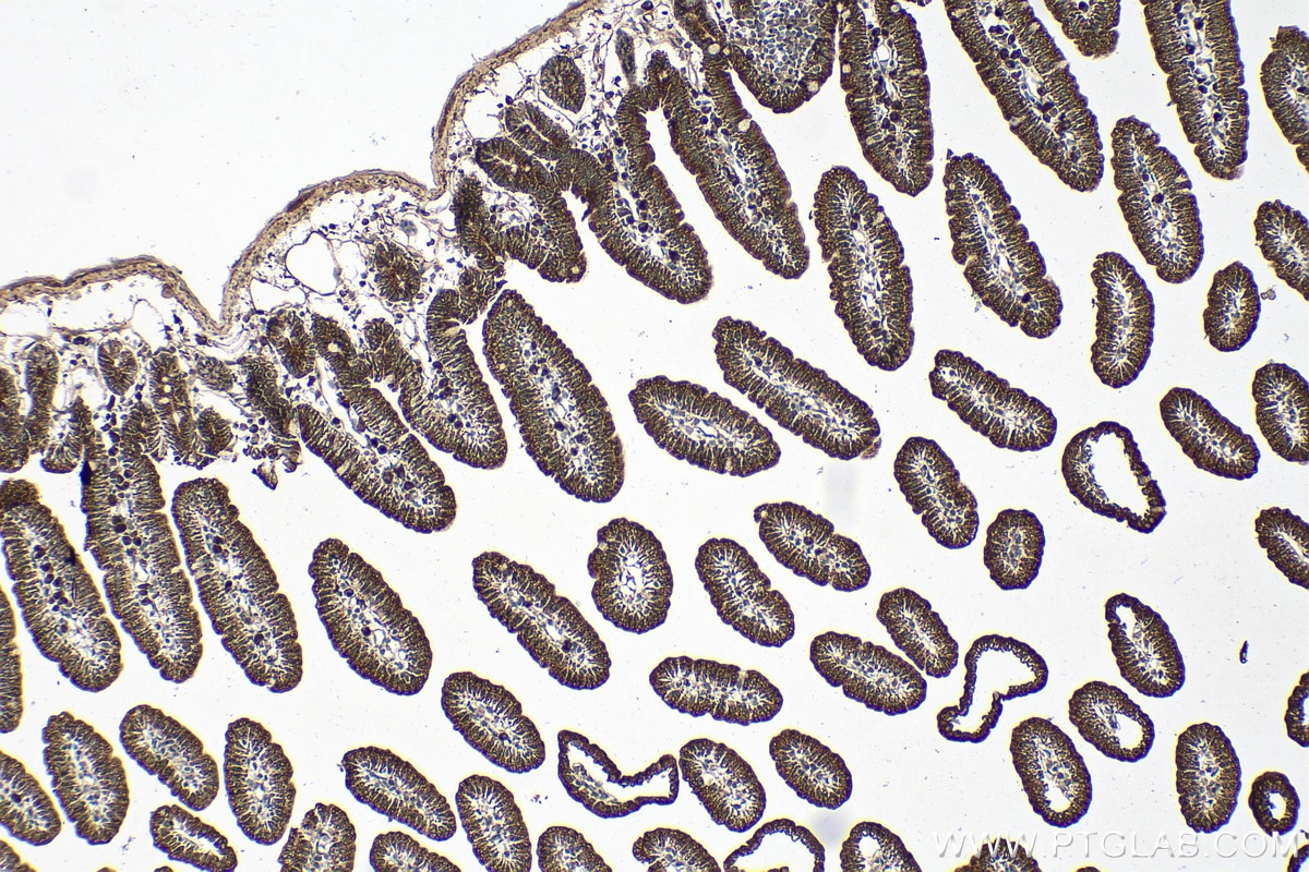 Immunohistochemistry (IHC) staining of mouse small intestine tissue using CES2 Polyclonal antibody (15378-1-AP)