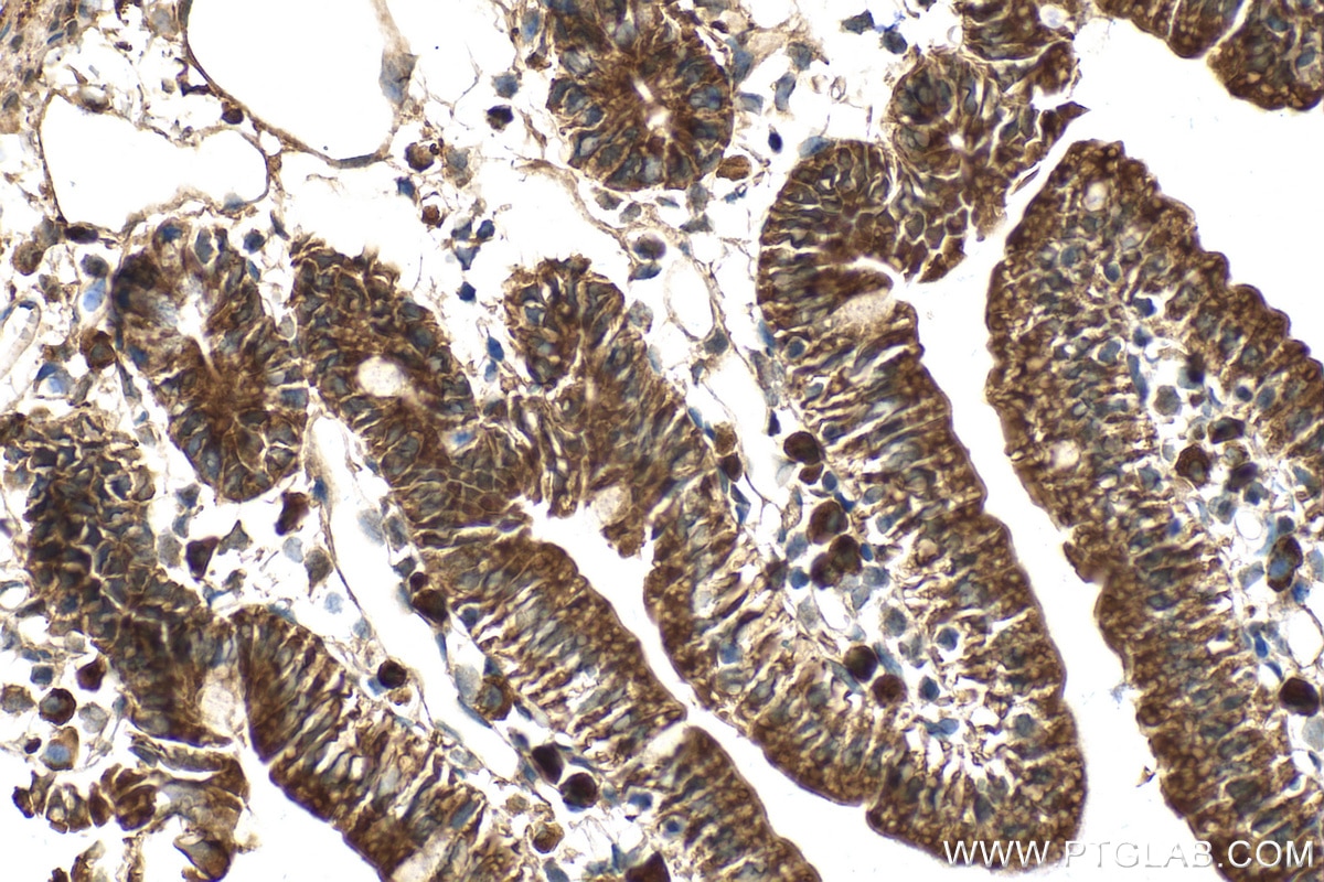 IHC staining of mouse small intestine using 15378-1-AP