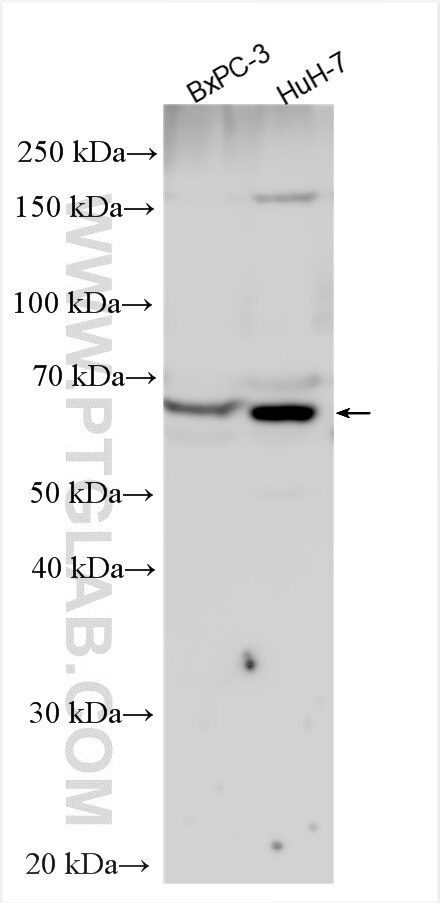 Western Blot (WB) analysis of various lysates using CES2 Polyclonal antibody (15378-1-AP)