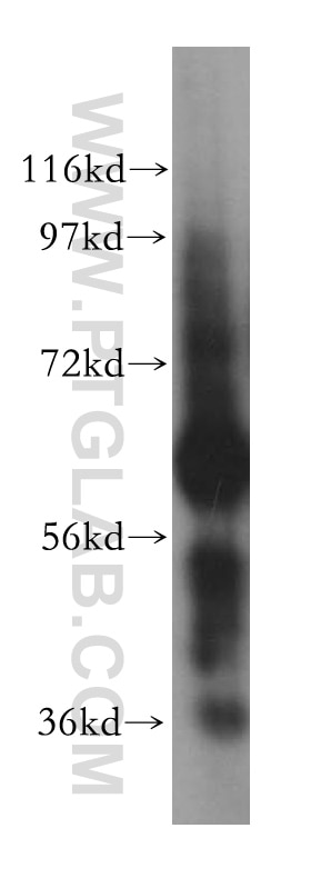 Western Blot (WB) analysis of human liver tissue using CES2 Polyclonal antibody (15378-1-AP)