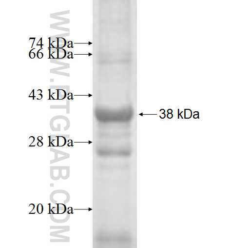 CES2 fusion protein Ag2218 SDS-PAGE