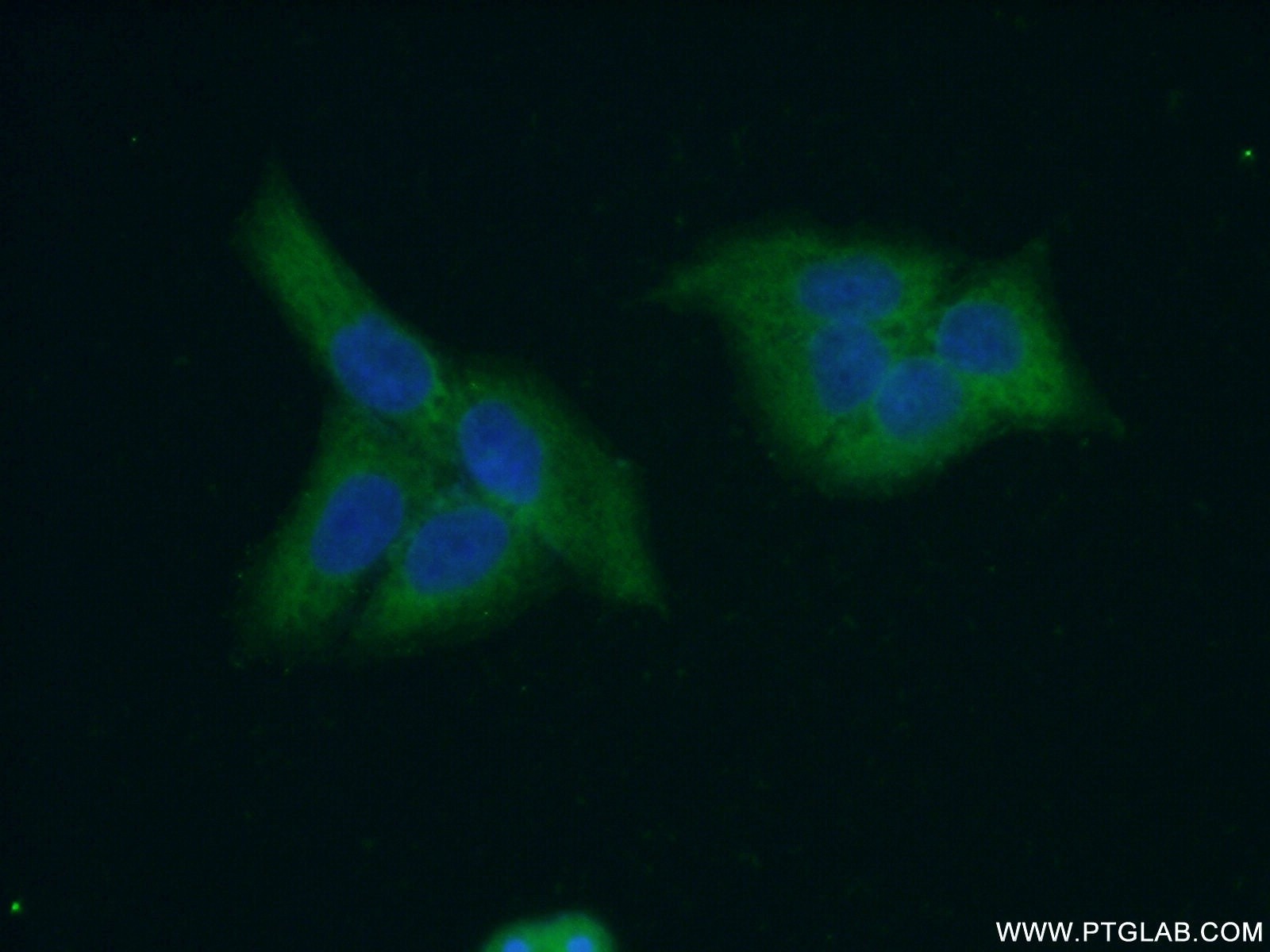 Immunofluorescence (IF) / fluorescent staining of HeLa cells using CES3 Polyclonal antibody (14587-1-AP)