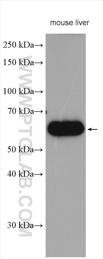 Western Blot (WB) analysis of various lysates using CES3 Polyclonal antibody (14587-1-AP)