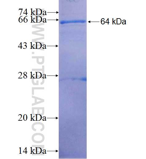 CES3 fusion protein Ag6113 SDS-PAGE