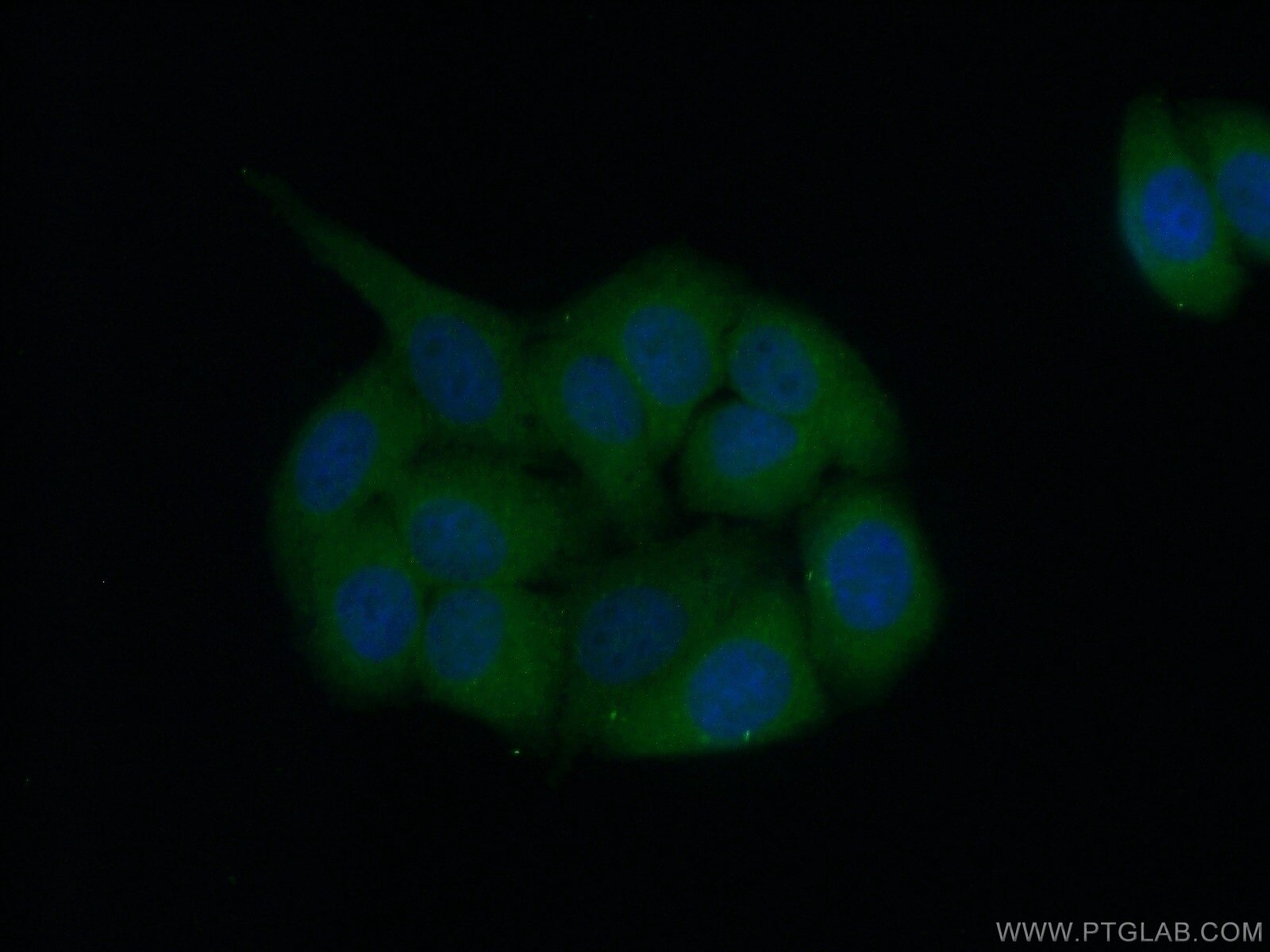 IF Staining of HepG2 using 19520-1-AP