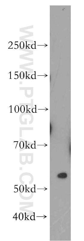 Western Blot (WB) analysis of HepG2 cells using CES7-Specific Polyclonal antibody (19520-1-AP)