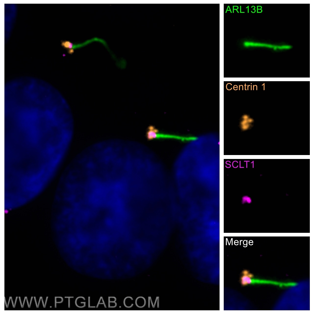 Immunofluorescence (IF) / fluorescent staining of hTERT-RPE1 cells using Centrin 1 Polyclonal antibody (12794-1-AP)