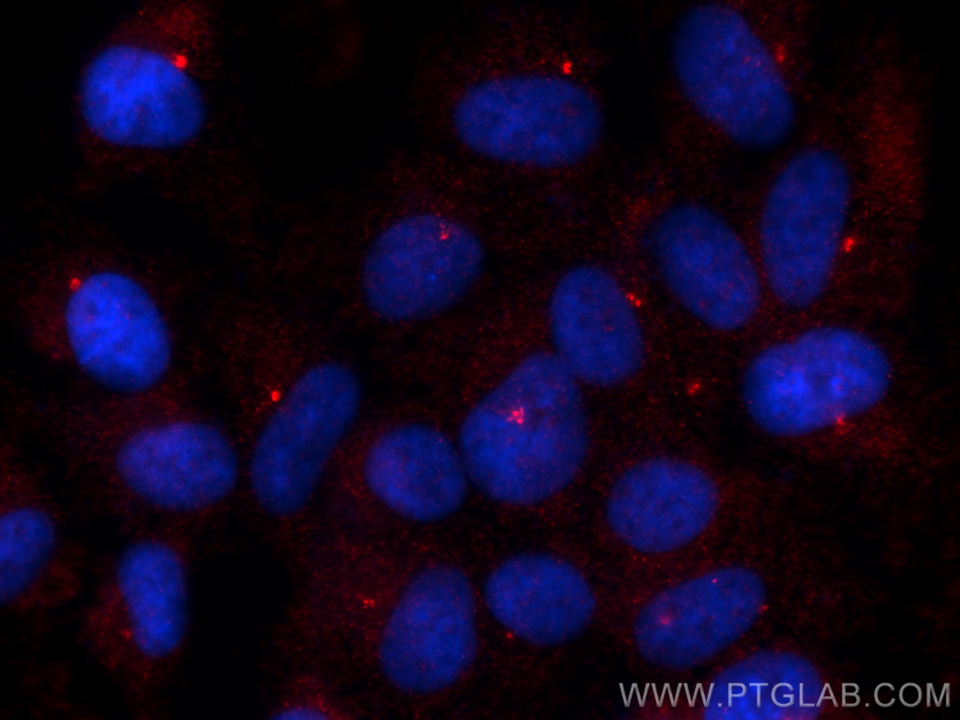 Immunofluorescence (IF) / fluorescent staining of hTERT-RPE1 cells using Centrin 1 Polyclonal antibody (12794-1-AP)