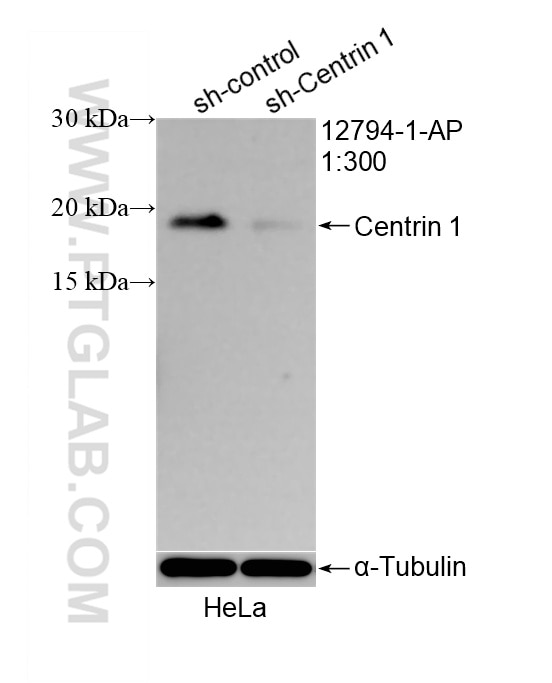 WB analysis of HeLa using 12794-1-AP Western Blot (WB) analysis of HeLa cells using Centrin 1 Polyclonal antibody (12794-1-AP)