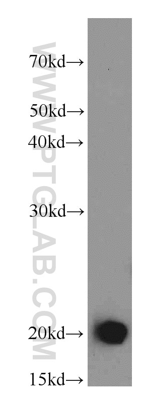 Western Blot (WB) analysis of HL-60 cells using Centrin 1 Polyclonal antibody (12794-1-AP)