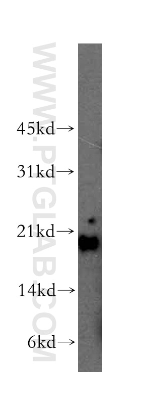 Western Blot (WB) analysis of human heart tissue using Centrin 1 Polyclonal antibody (12794-1-AP)