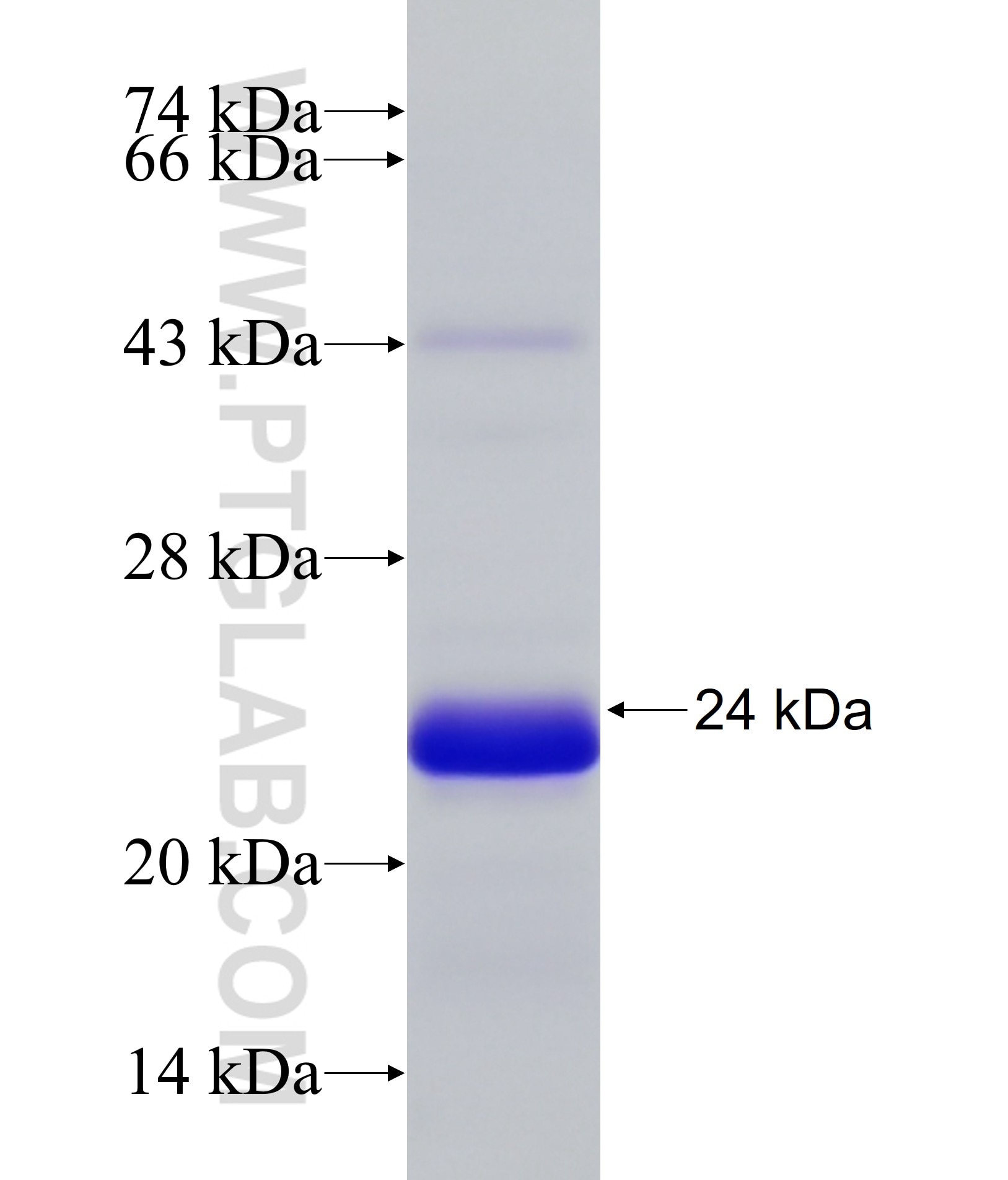 CETN1 fusion protein Ag33734 SDS-PAGE CETN1 fusion protein Ag33734 SDS-PAGE