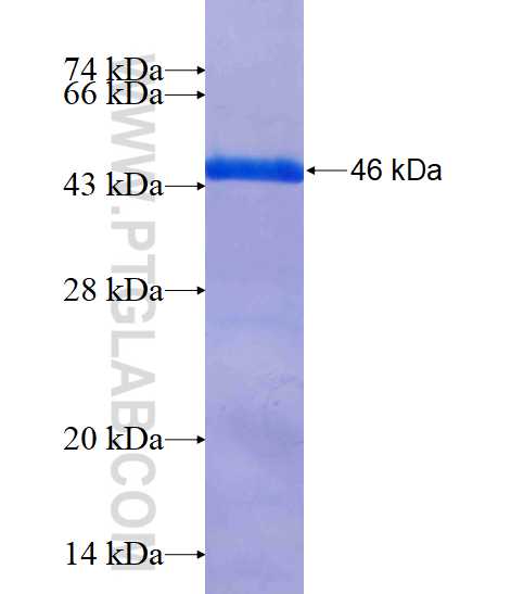 CETN1 fusion protein Ag3529 SDS-PAGE
