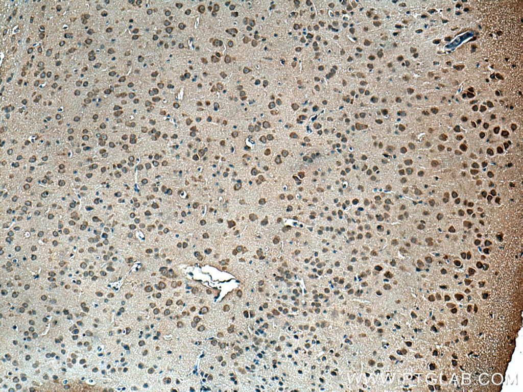 IHC staining of mouse brain using 15877-1-AP