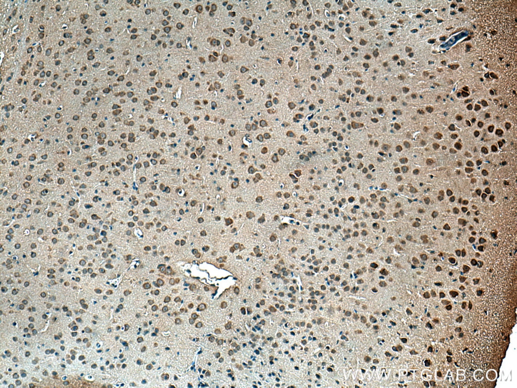 Immunohistochemistry (IHC) staining of mouse brain tissue using Centrin 2 Polyclonal antibody (15877-1-AP)