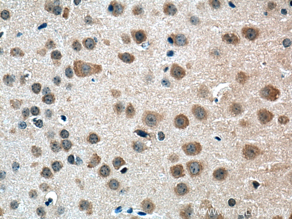 Immunohistochemistry (IHC) staining of mouse brain tissue using Centrin 2 Polyclonal antibody (15877-1-AP)