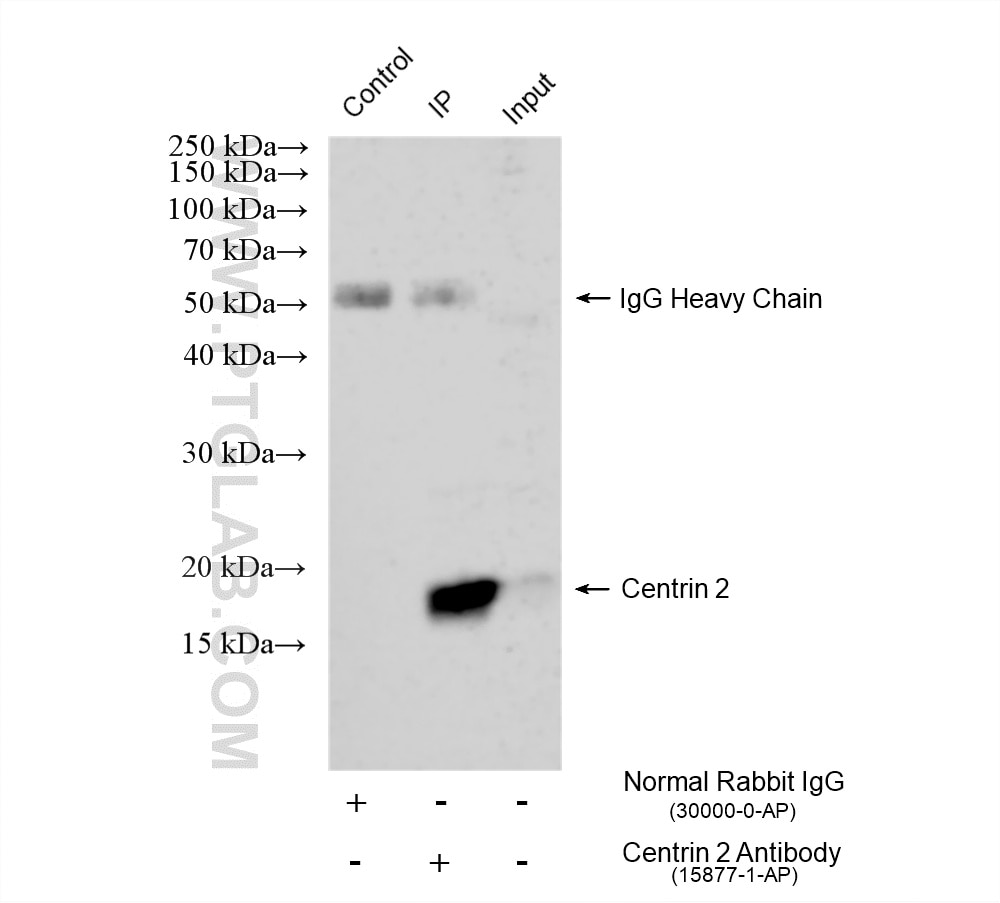 Immunoprecipitation (IP) experiment of mouse brain tissue using Centrin 2 Polyclonal antibody (15877-1-AP)